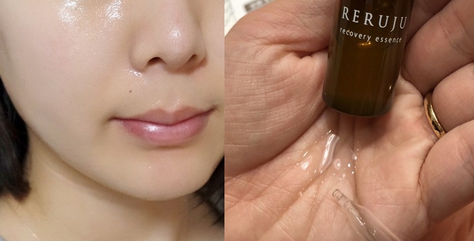 実話 穴があいたように広がった毛穴が1週間でツルっ 女優やモデルが絶賛する毛穴ケアが凄かった