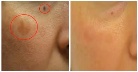 DUOザクレンジングバームホワイトを渡辺美奈代も愛用！効果が口コミで評判のシミや毛穴ケアとは